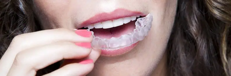 invisalign adults-Dental Touch-Cedar Rapids IA